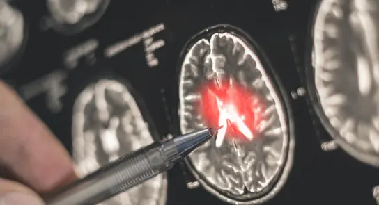 A hand points to a highlighted area on a brain scan, indicating a potential issue or abnormality.